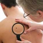 Доброкачественные опухоли кожи: названия, причины возникновения, симптомы, диагностика и лечение
